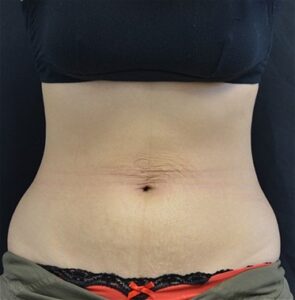 After Image: Back