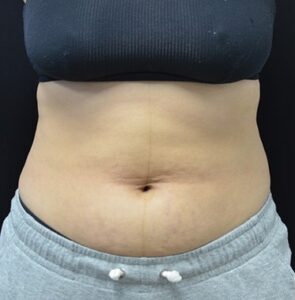 Before Image: Back