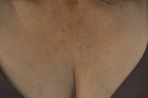 After Image: Decollette