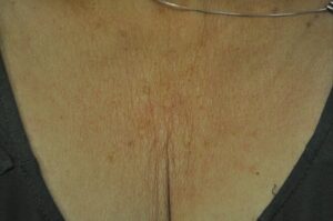 Before Image: Decollette