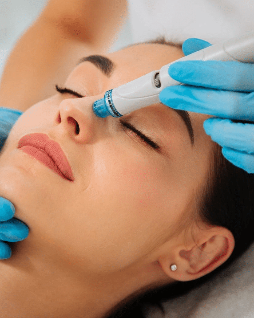 hydrafacial
